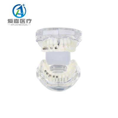 China Vivid Anatomy New Ceramic Semiceramic Frames Dental Orthodontic Model With Quality Assurance for sale