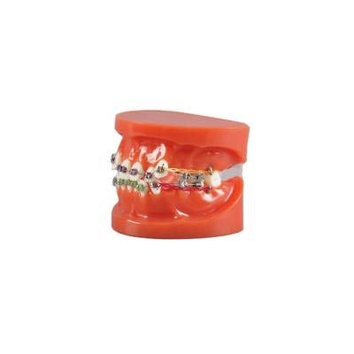 China Detailed Anatomy Structures China Wholesale Treatment Education Dental Models Orthodontic Teeth Model For Study for sale