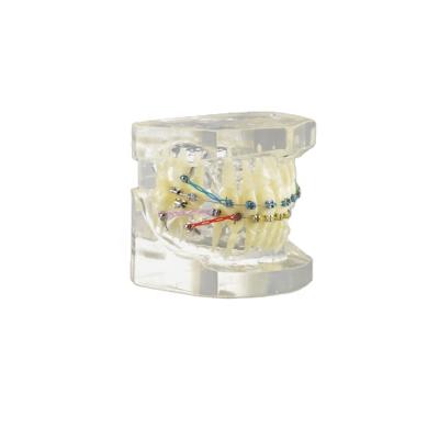 China Orthodontic Clear Structure Popular Buccal Tube Display Orthodontic Transparent Dental Model With Factory Price for sale