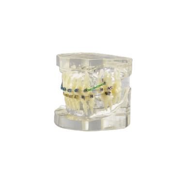 China Niti Archwire Clear Teeth Brace Factory Directly Supply Orthodontic Model With High Quality Structure Display for sale