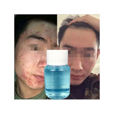 China Anti Moisturizer Tea Tree Acne Face Beatury Serum Set Vitamin C Whitening Serum Oil For Face Bulk Ingredients for sale