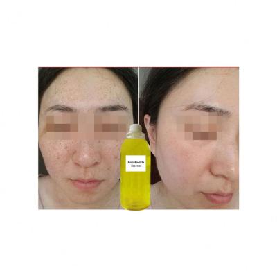 China OEM Bulk Ingredients Moisturizer Anti Agingfacial Serum Organic Bulk Vitamin C For Face for sale