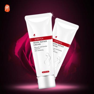 China 2021 hot sale smooth lighting and supply increase skin elasticity body cream health ingredients rich innatural stretch marks cream for sale