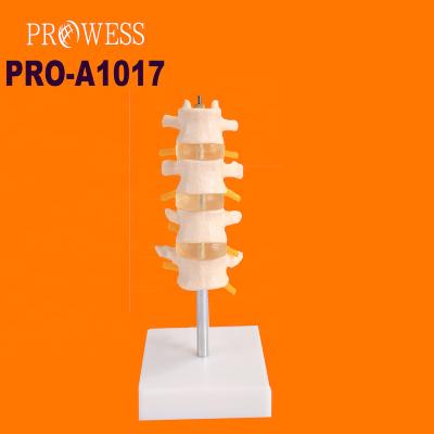 China Detailed Anatomy Structures PRO-A1017 High Quality and Medical Sections Normal Model Four Lumbar Vertebrae Combination for sale