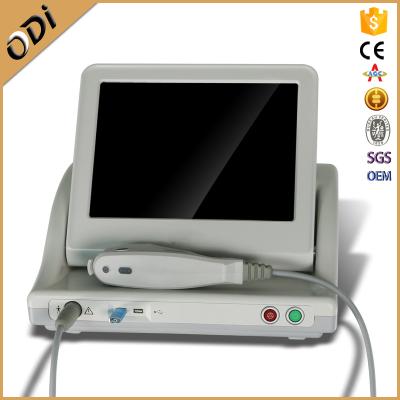 China High Intensity Focused Ultrasound Anti Aging Face Lift And Wrinkle Removal Machine for sale