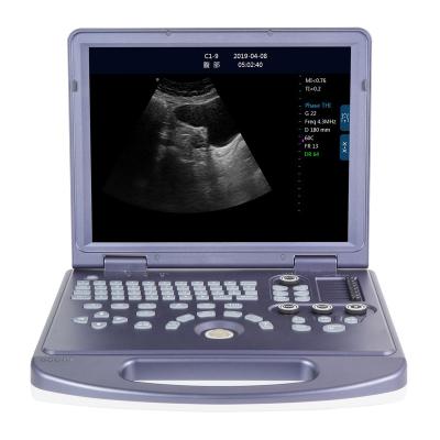 China Portable 2D Ultrasound Scanner PC Metal Laptop Ultrasound Scanner with Best Deal for sale