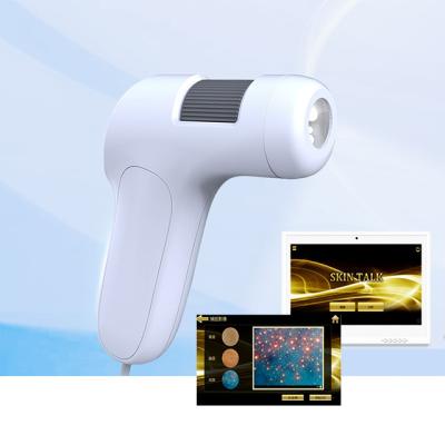 China Acne Analysis 3 in 1 Beauty Analysis Facial Machine for sale