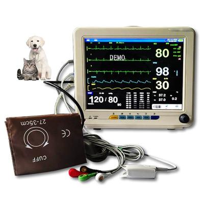 China 12 Inch Rechargeable Battery Arrhythmia Analysis St Hospital Clinic Home Rescue Segment Analysis Holter Multiparameter Veterinary Patient Monitor for sale