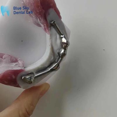 China Customizable Dental Titanium Bar With Abutment Teeth For Dental Prosthesis for sale