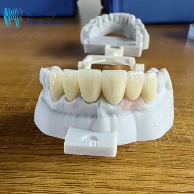 China Highly Translucent Layered Zirconia Crowns Natural With Implant Crown for sale