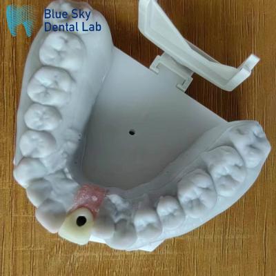 China Steam Sterilization Single Implant Crown Smooth Surface Dental Implant Crown for sale