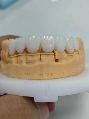 China 5mm-6mm Layered Zirconia Crowns Strength Zirconia Multilayer Crown for sale