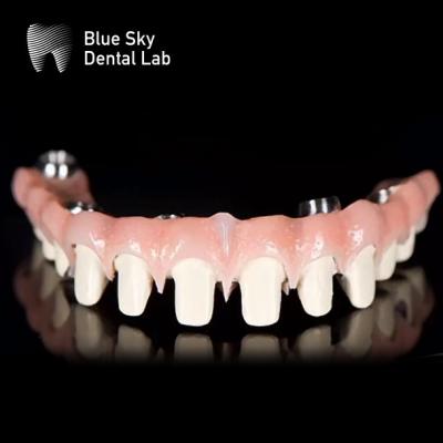 China Customizable Pure Titanium Malo Bridge Dental Blue Sky Implant System for sale