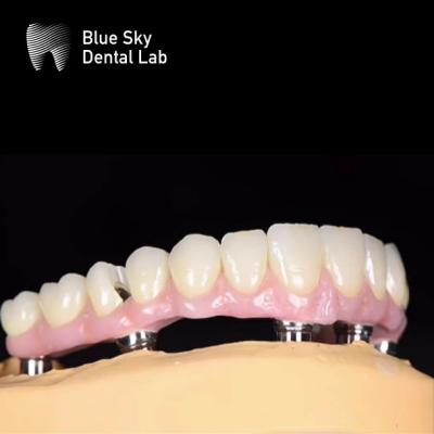 China Blue Sky Nature Tandheelkundige Implantat Hoesje Meerdere keuzes Implantat systeem Te koop