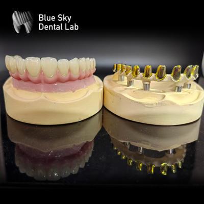 China Screw retained MUA abutment Implant Cases Zirconia crowns Multilayer pink porcelain with Easy repair for sale