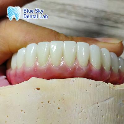 China Universal Compatibility Implant Cases Customize Full Mouth Implant Case for sale