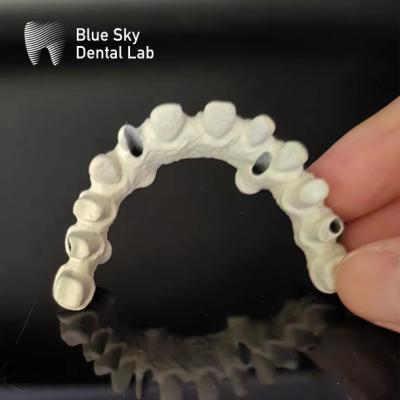 China Titanium Frame Malo Bridge Dental Custom Malo Implant Bridge for sale