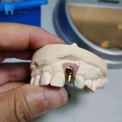 China Regular Implant Cases Customizable Single Implant Tooth  Offset Arch Implant Case for sale