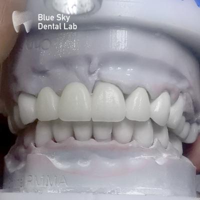 China Rectangular Layered Zirconia Teeth Multilayer Before Glazing for sale