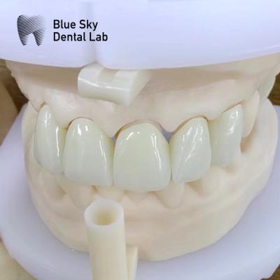 China Natural Esthetics Multi Layered Zirconia Crown High Strength Chemical Resistance for sale