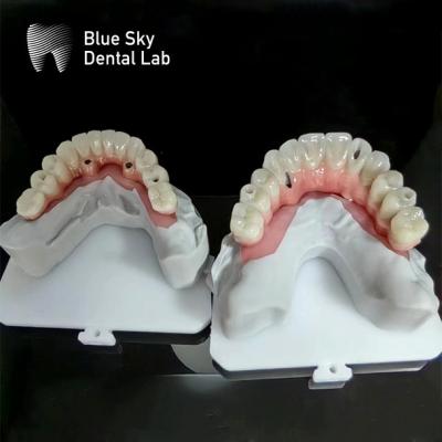 China Blue Sky Implant Full Arch Implant Cases Nature Implantation Cases for sale