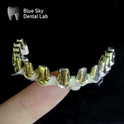 China Silver Gold Universal Pure Titanium Metal Frame Dental Customizable for sale