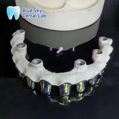 China Pure Titanium Malo Bridge Customizable Silver Metal Frame Teeth for sale