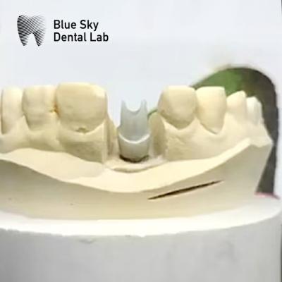 China Aesthetic Zirconia Abutment Implant Biocompatible Precision Milled for sale