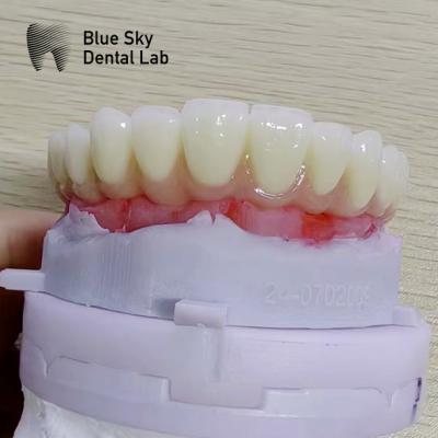 China Nature Implant Procedure Cases with Universal Compatibility and Optimal Performance for sale