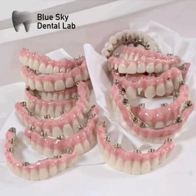 China Blue Sky Implantat Hoesjes Met Malo Frame Bridge Puur Titanium Te koop