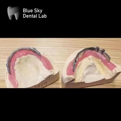 Chine Implants dentaires Blue Sky Bar de titane argenté Pour les implants dentaires à vendre