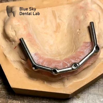 China Full Upper Dental Titanium Bar Full Mouth Restoration Blue Sky Implant for sale