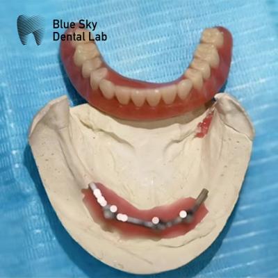 China Blue Sky Implant Titanium Bar Dental For Implant Dentures for sale