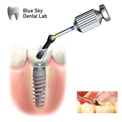 China Interne hex-ASC-abutment Verstelbare hoekige schroefkanaal-abutment Te koop