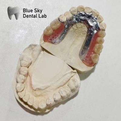 China Adjustable Denture Metal Framework Resin Teeth Rpd Metal Framework for sale