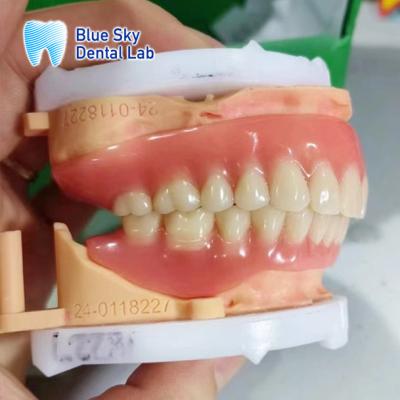 China Dentadura de arco completo removível de acrílico Dentadura de aparência natural personalizável à venda