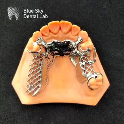 China Comfortable Denture Metal Framework Only Make Framework for sale