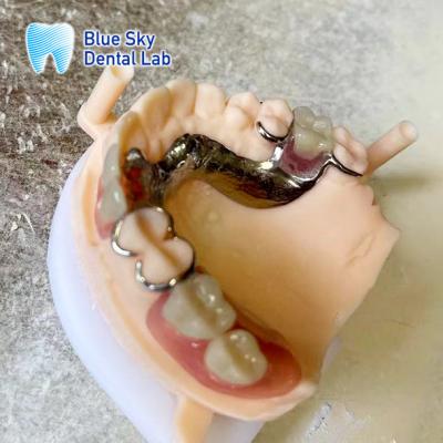 China Lightweight Acrylic Resin Partial Denture With Metal Frame Realistic Looking Dentures for sale