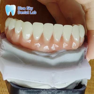 China Comfortable Full Acrylic Denture Natural Looking Acrylic Resin Denture for sale