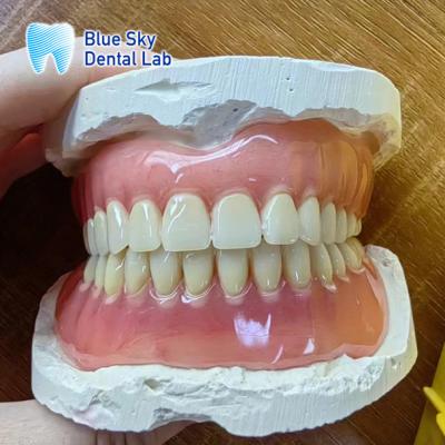 China Missing Teeth Acrylic full Denture Restoration Acrylic Complete Denture for sale