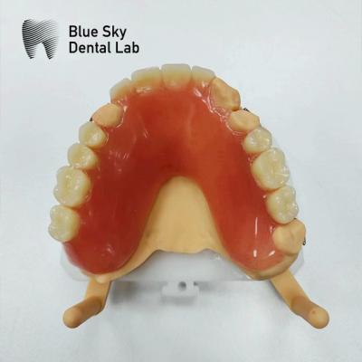 China Restoration Full Upper Acrylic Denture Blue Sky Removable Acrylic Denture for sale