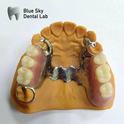 China Dental Cast Partial Denture Framework Partial Dentures That Look Real for sale