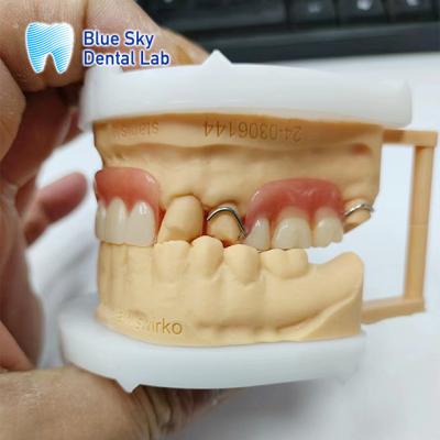 China Smile Restoration Partial Acrylic Denture with clasps for sale