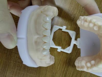 China E.Max Veneer Cases Passive Fitting in Multiple Colors MAKE beautiful smile with  Minimal tooth preparation for sale