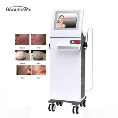 China Skin Rejuvenation Gold Fractional Microneedle RF Microneedle Device / Radio Frequency Non Invasive Remove Wrinkle Skin Rejuvenation Machine for sale