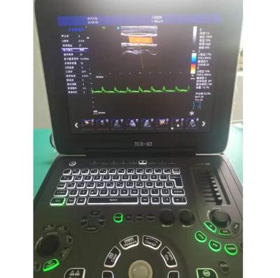 China RUIHUA Portable Ultrasound Acrylic Medical Instruments Cheap Cardiac Portable Hospital and Clinic Ultrasound Machine for sale