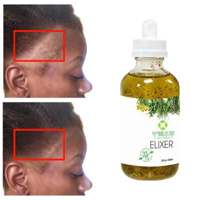 China Moisturize Private Label 100% Natural Formula Scalp Elixirs Hair Care Loss Treatment Hair Loss Nourishing Oil Serum Wholesale for sale