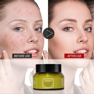 China Wholesale Moisturizer Factory Private Label Green Tea Formula 2% Salicylic Acid Face Whitening Anti Spot Acne Cream for sale