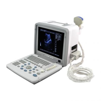 China Portable Full Metal Digital Ultrasound Scanner Without Probe (Element 80) for sale