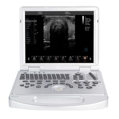 China carejoy laptop 15 inch led screen color doppler acrylic portable ultrasound scanner for sale